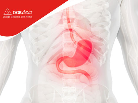 Mengenal Stress Ulcer dan Implikasi Klinisnya