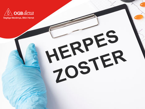 Peran Valaciclovir dalam Meningkatkan Outcome Klinis dan Kualitas Hidup Pasien Herpes Zoster